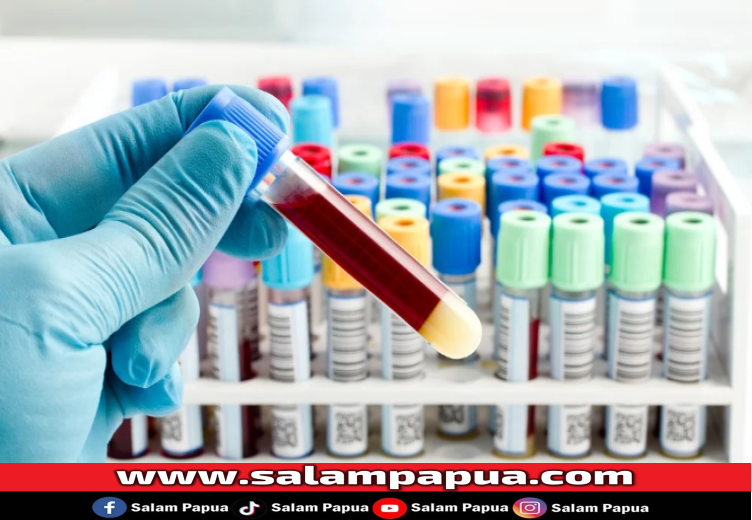 Berbagai Jenis Cek Darah Untuk Mendiagnosis Demam Berdarah