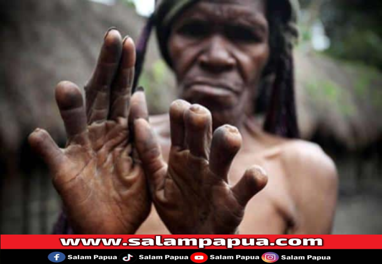 Tradisi memotong jari (Keluyuran.com)