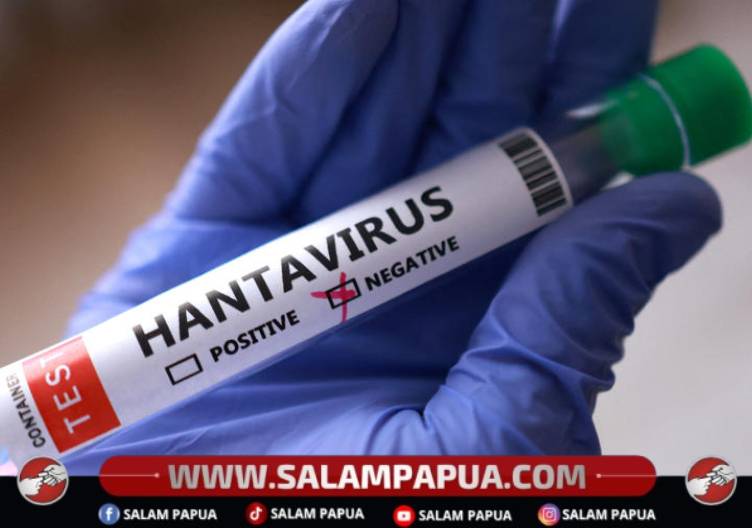 Waspada Hantavirus, Virus Dari Tikus Yang Bisa Sebabkan Gangguan Paru Dan Ginjal