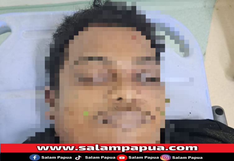 Tabrak Median Jalan, Dua Pemuda Tewas Mengenaskan Di Jalan Hasanuddin Timika