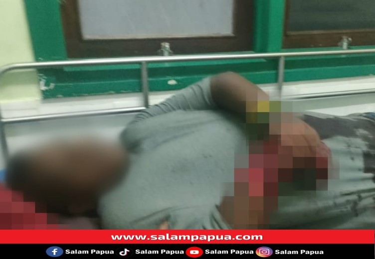 Seorang Siswa SMK Di Timika Ditebas OTK Hingga Tangan Nyaris Putus