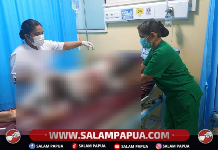 Diduga Dibakar Orang Tua, Remaja 15 Tahun Di Sentani Timur Meninggal Dunia Setelah Dirawat 12 Hari