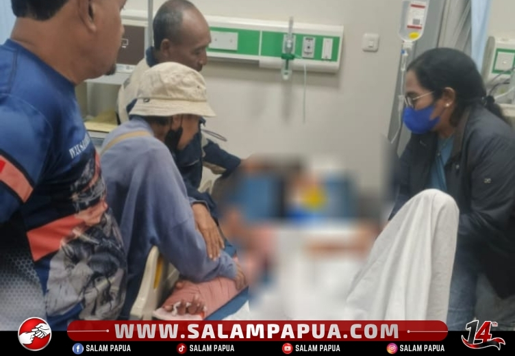 Tabrakan Mobil Dan Motor Di Tikungan Iripau Mapurjaya, Pengendara Motor Alami Luka Parah