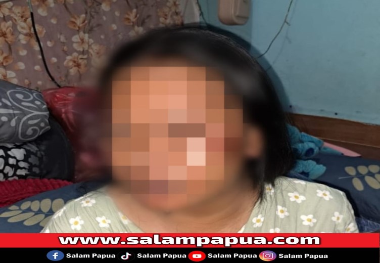 Pramuria Kilo 10 Babak Belur Dianiaya Tamu, Pelaku Terus Dicari Polisi