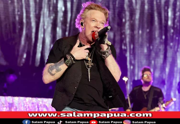 Axl Rose (Superprof.co.id)