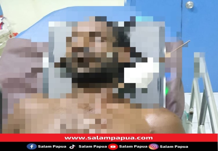 Sama-Sama Dalam Pengaruh Miras, Leher Warga Jayanti Dipanah Pamannya