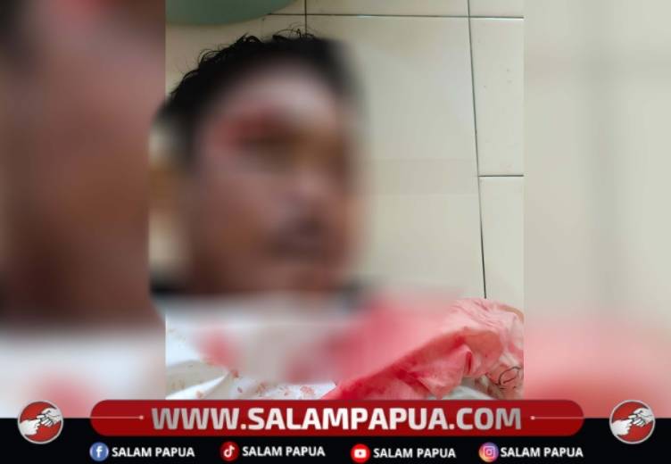 Seorang Pria Ditemukan Tewas Di Kolong Truk Di Jalan Irigasi Timika